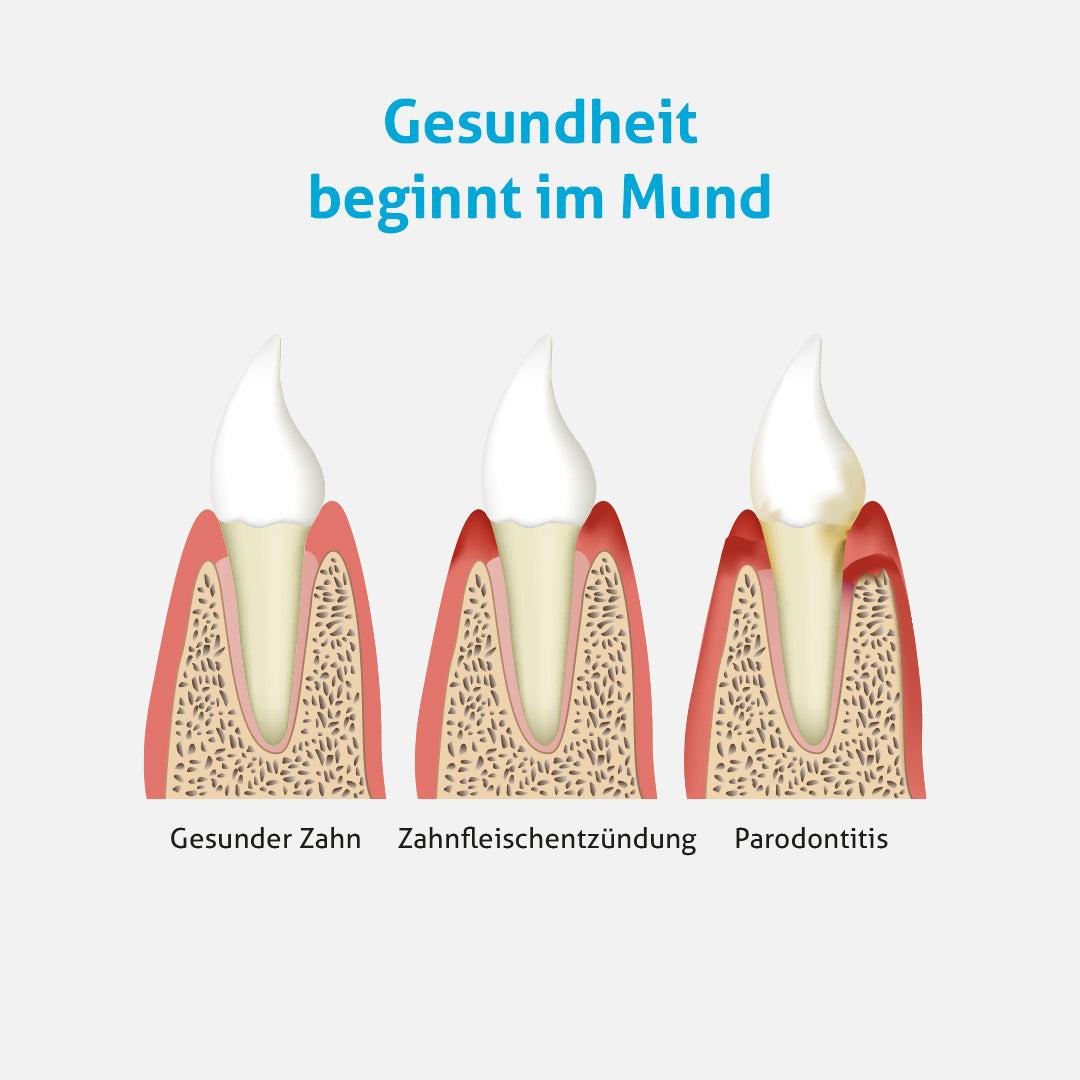 DentoMit® Mundpflegespray
